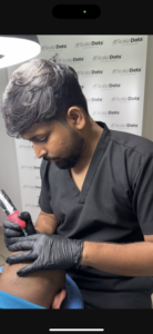 Scalp Micropigmentation