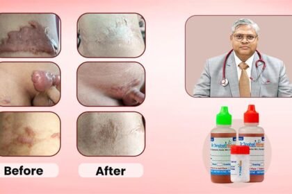Dr. Vikas Singhal
